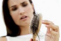 Chute de cheveux sévère - causes et traitements